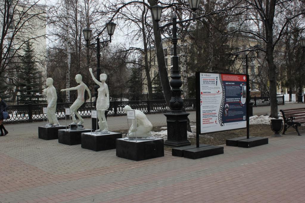 «Жизнь с болью»: необычная выставка скульптур открылась в Центральном парке Тулы